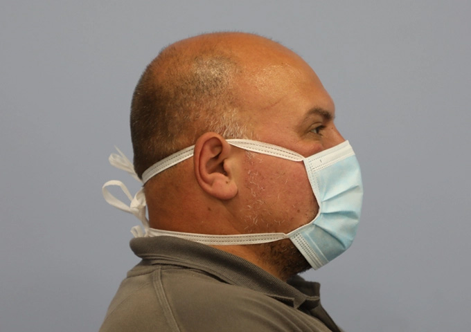 Obisk Type IIR Tie Back Surgical Mask Side Profile